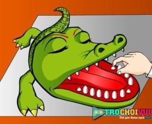 Khám răng cá sấu